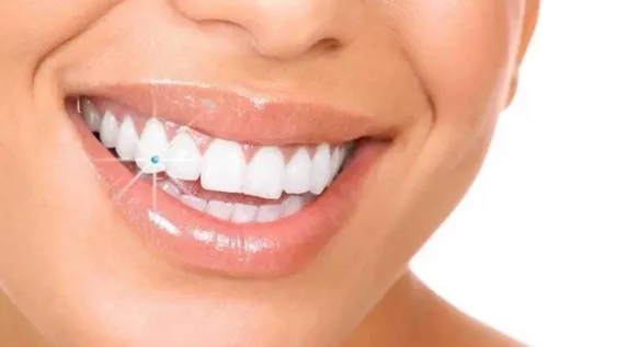 ¿Qué es el piercing dental?