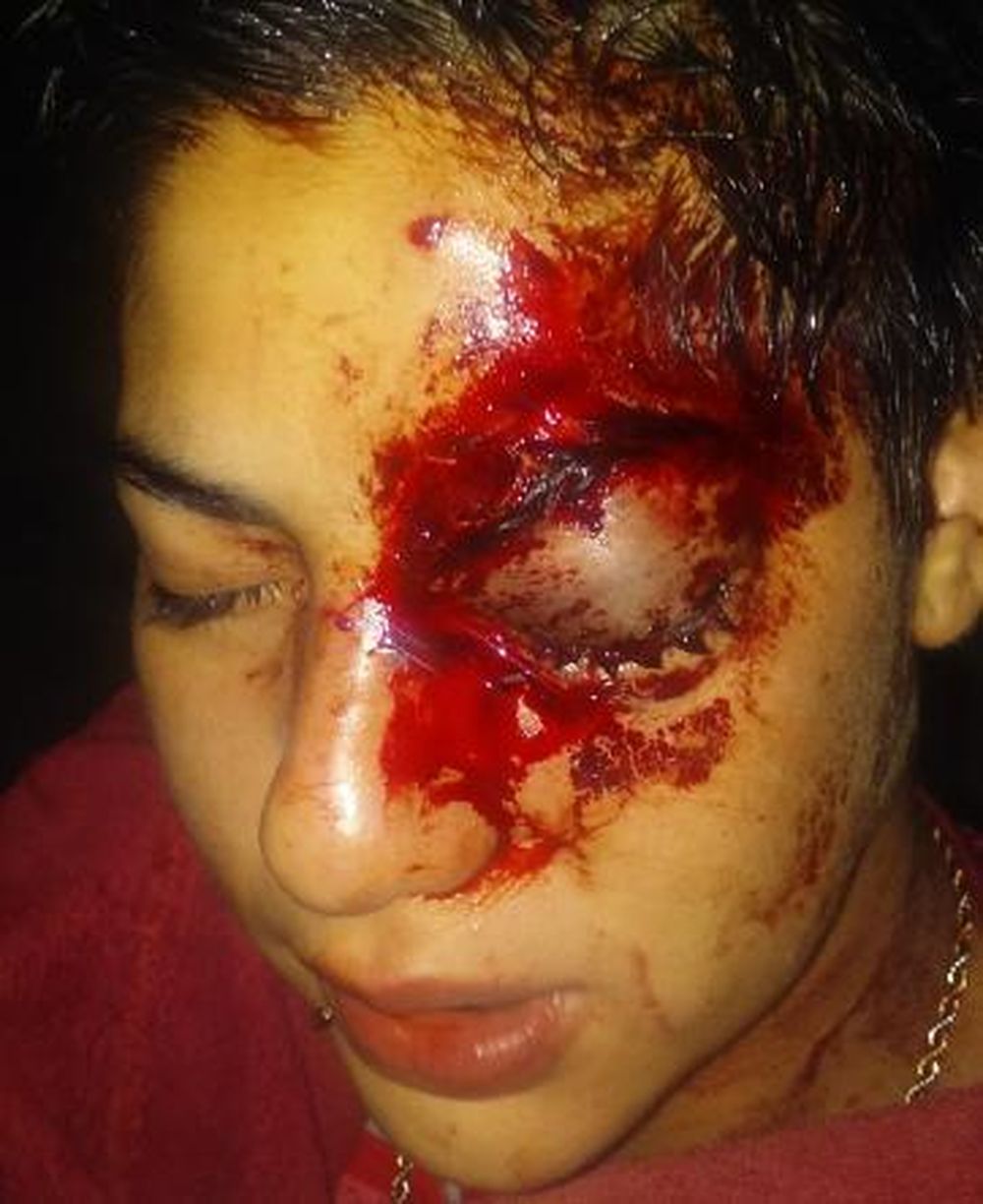 Brutal ataque a una joven para robarle 270.000 pesos