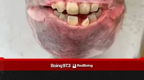 Capturó un pez con “dientes humanos”