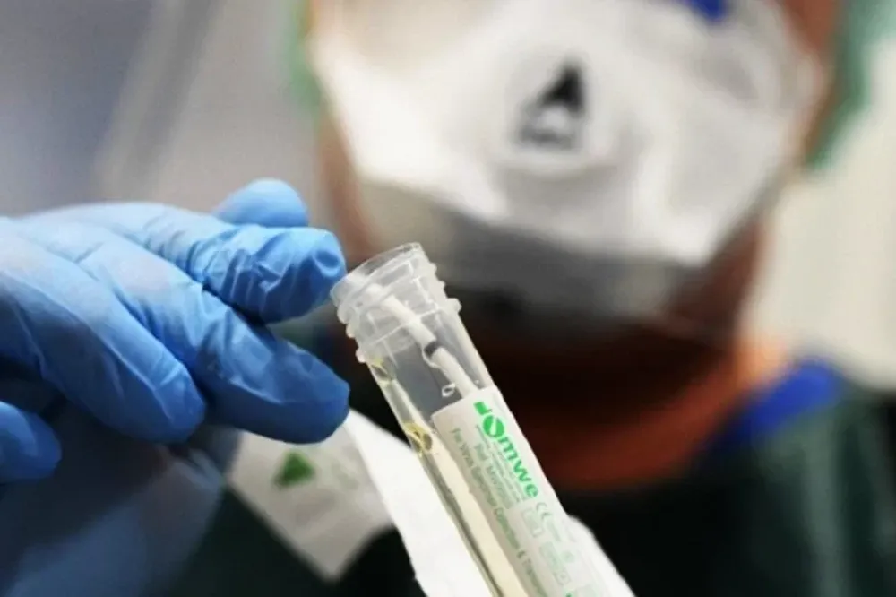 Argentina superó las 55.000 víctimas fatales por coronavirus