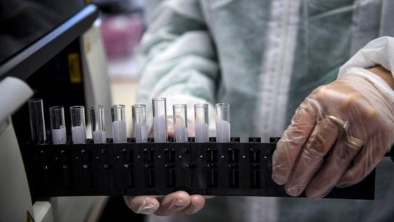 Un anticoagulante podría detener el ingreso de Covid-19 a las células