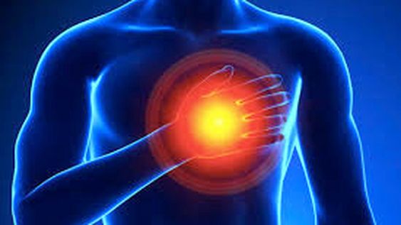 Más de 50 mil infartos por año y alta mortalidad en Argentina