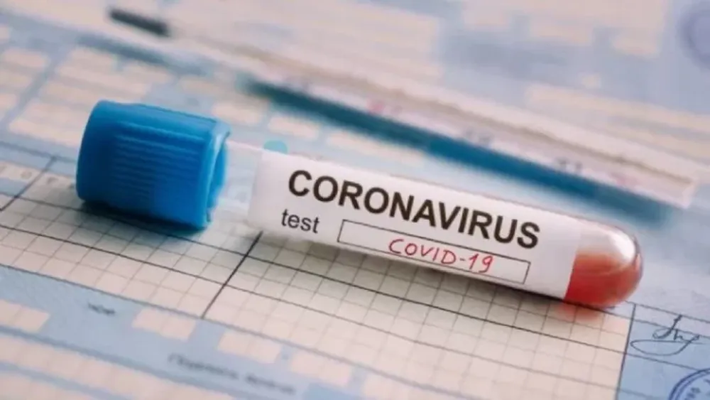 Sugieren que el coronavirus no es tan mortal como se cree
