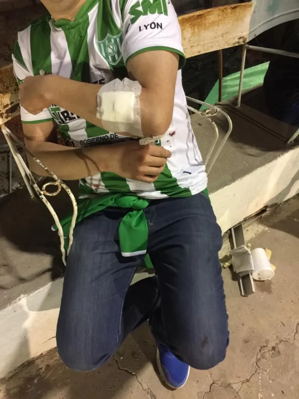 Un perro de la Policía mordió a un hincha de Sportivo y tuvieron que hacerle 8 puntos