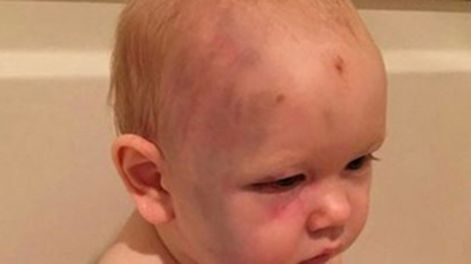 Niñera golpeó a un bebé pero no será detenida porque el nene no puede denunciarla