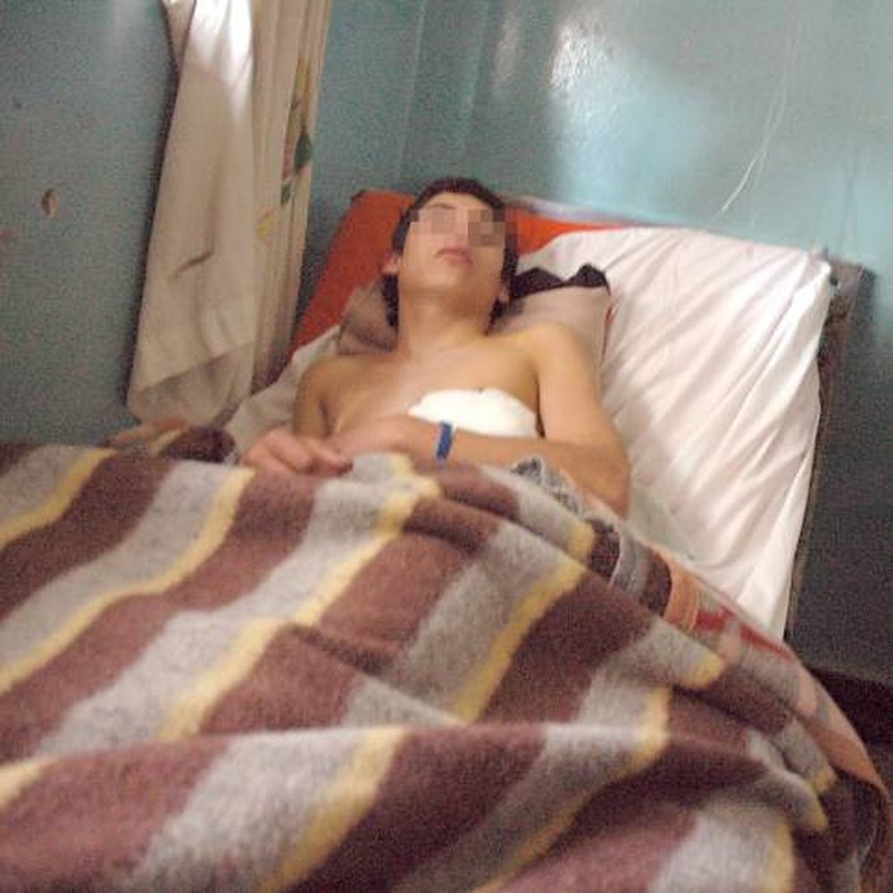 Por evitar un robo, casi lo matan de una pedrada