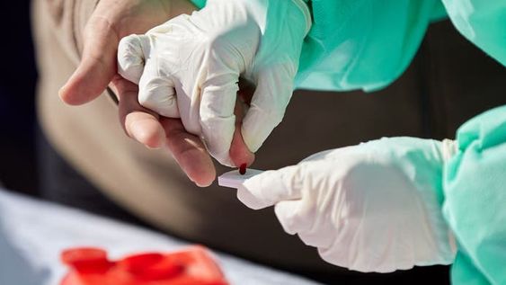 Dejan de publicar datos sobre testeos de Covid-19 en Argentina por no ser confiables