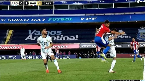 Exequiel Palacios sufrió una fractura en la columna por el rodillazo de Ángel Romero