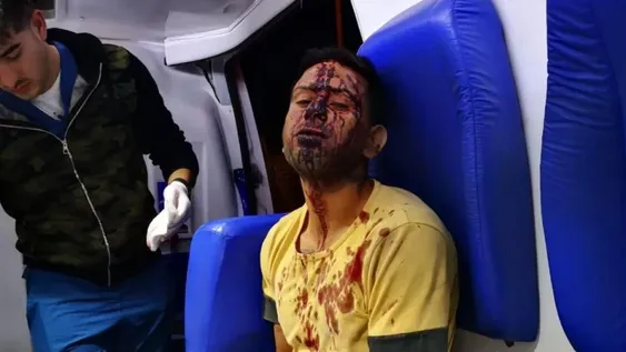 Fue sorprendido robando  y se desfiguró la cara contra el patrullero al ser detenido