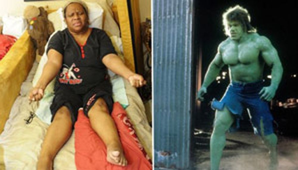 La Increíble Hulk