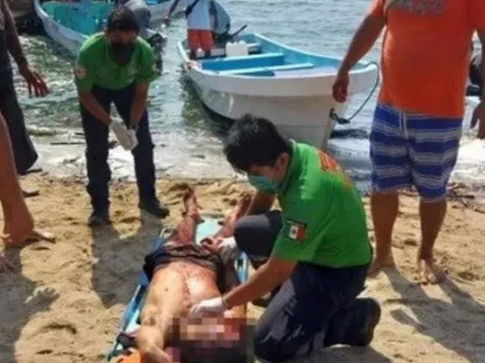 Atacaron a machetazos a tres jóvenes argentinos en la costa mexicana