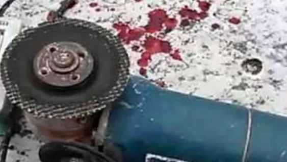 Tres accidentes con amoladoras: corte de tendón en una mano, otro en brazo y uno en pie