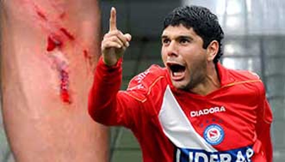 El capitán de Argentinos dijo que lo que hizo Lamela “es de poco hombre”