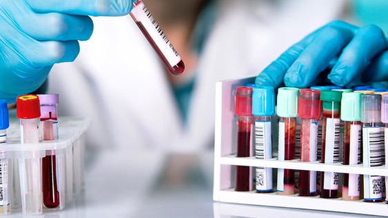 Seis cosas que se debe saber sobre los virus de las hepatitis