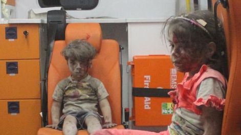 Un nene herido, la nueva cara de la guerra en Siria