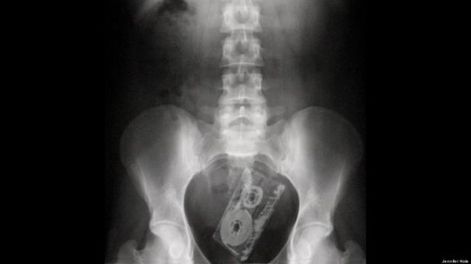 Radiografías insólitas