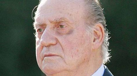 Operan de urgencia a Juan Carlos I, Rey de España