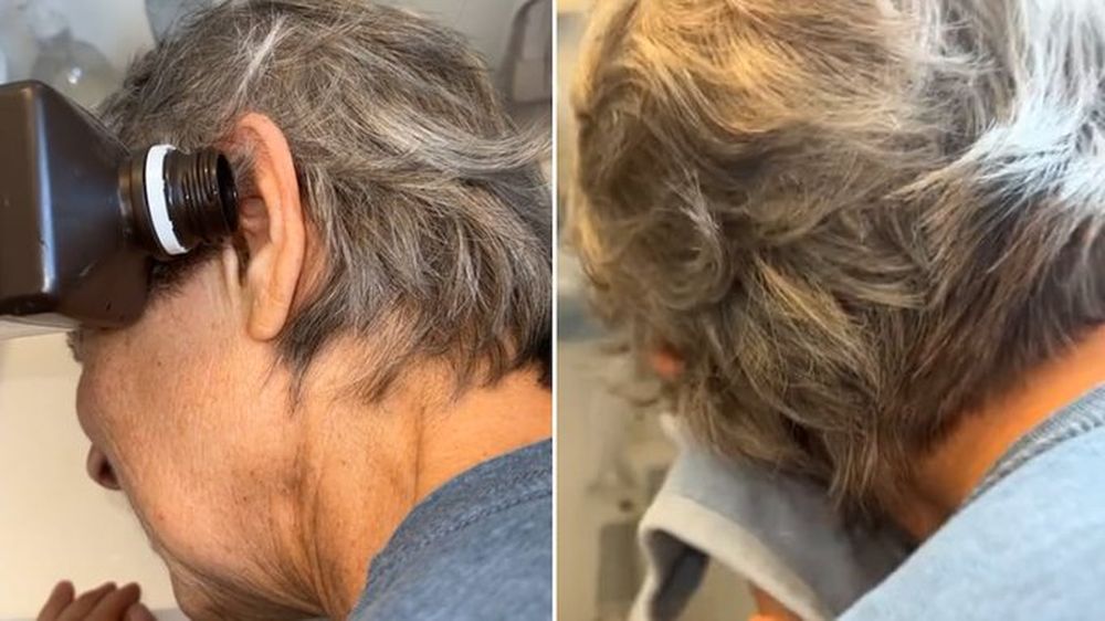 Una mujer sintió que algo caminaba en el oído, se tiró agua en el interior y descubrió lo peor