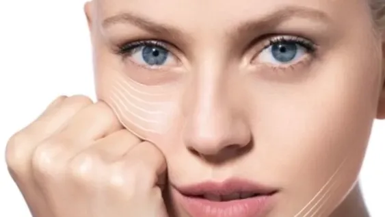 Profhilo, magia para la piel