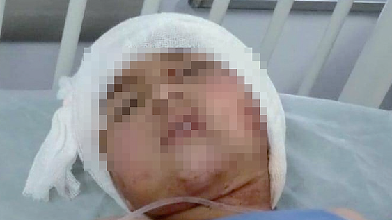 Isaías dio una buena señal y su madre está disgustada con el familiar dueño del perro