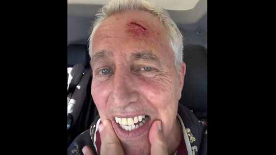 Marley debió ser atendido por un corte profundo en su frente.&nbsp;