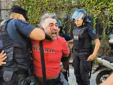 El momento que un camarógrafo es detenido después de ser agredido por la policía frente al Congreso Nacional. El momento que un camarógrafo es detenido después de ser agredido por la policía frente al Congreso Nacional.