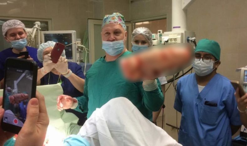 Fue al hospital por un dolor intenso y le extrajeron un consolador enorme del abdomen