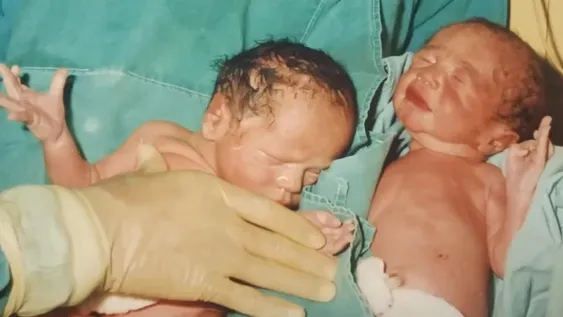 Euge y Edu, los bebés nacidos por fecundación in vitro que marcaron un hito en San Juan