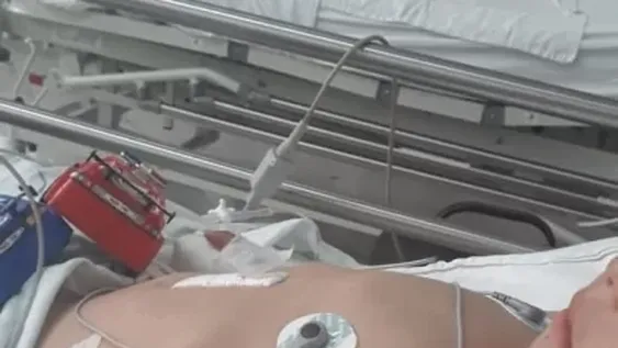 Feroz ataque de dos dogos y un pitbull a un nene de 3 años