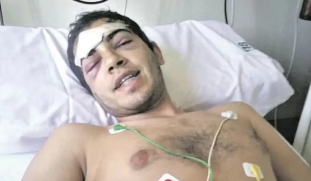 Una patota le fracturó la cabeza a un joven en una pelea adentro de un boliche