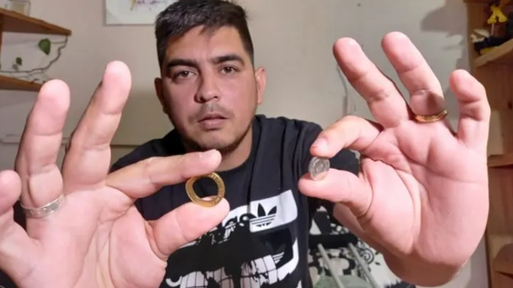 Lo asaltaron, le dispararon y una moneda le salvó la vida