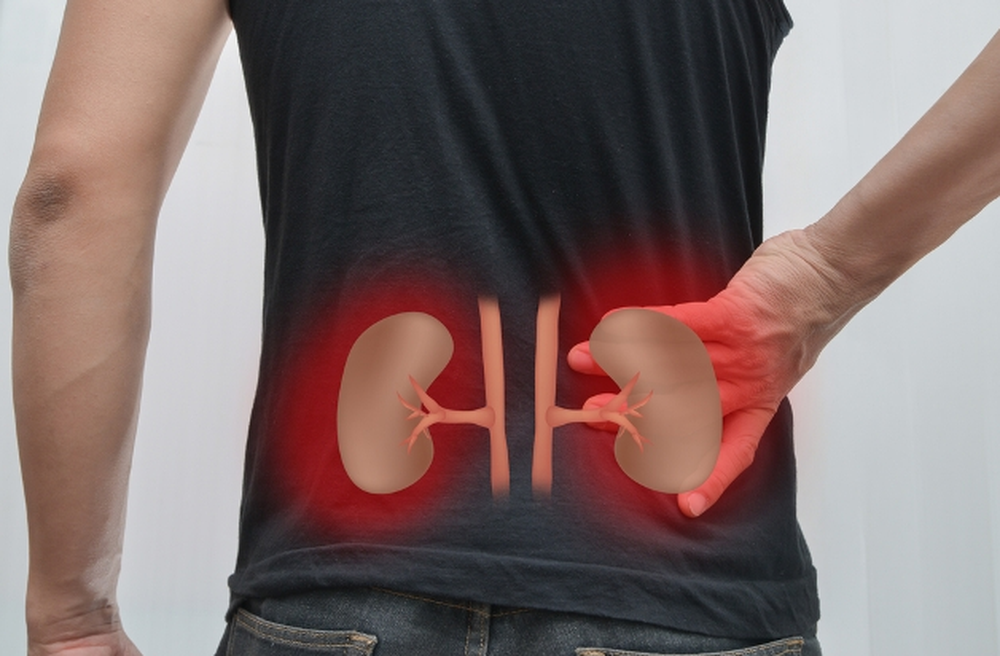 Para 2040, la enfermedad renal puede llegar a ser la 5ta causa de muerte