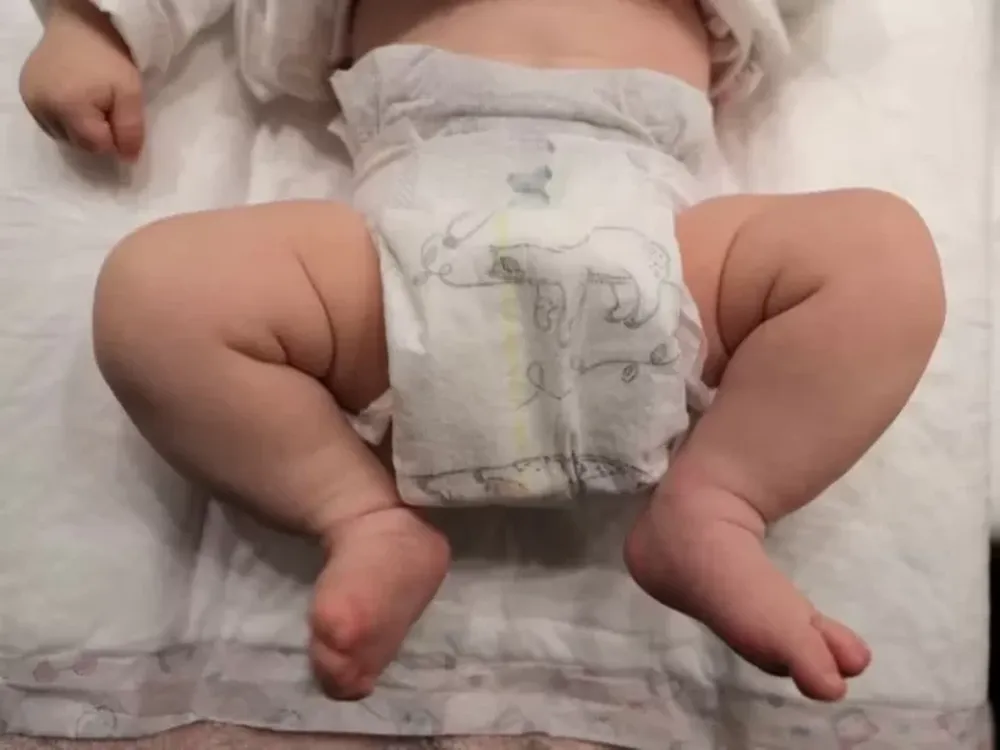 Nacieron las primeras dos bebés concebidas por un robot