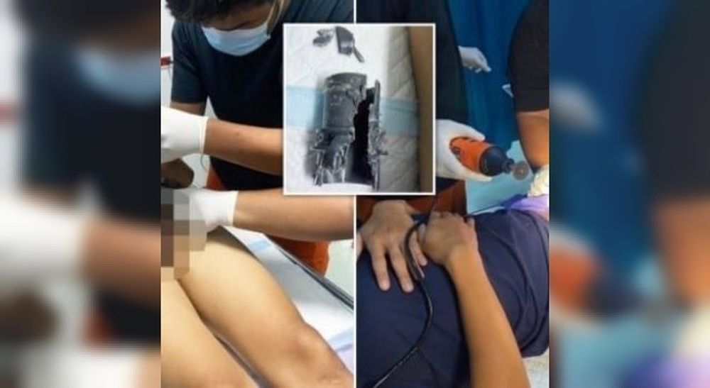 Se agrandó el pene y se le quedó atascado en un tubo