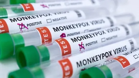 Confirmaron el noveno caso de viruela del mono en Argentina