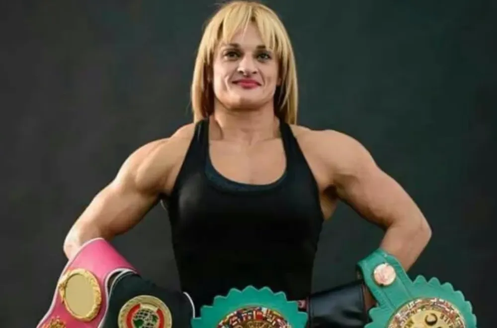 La “Locomotora” Oliveras sigue en estado “muy crítico” y con “pronóstico reservado”