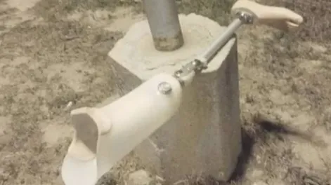 Se emborrachó, perdió su pierna ortopédica y la encontró dos días después