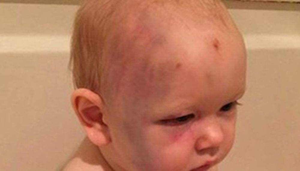 Niñera golpeó a un bebé pero no será detenida porque el nene no puede denunciarla