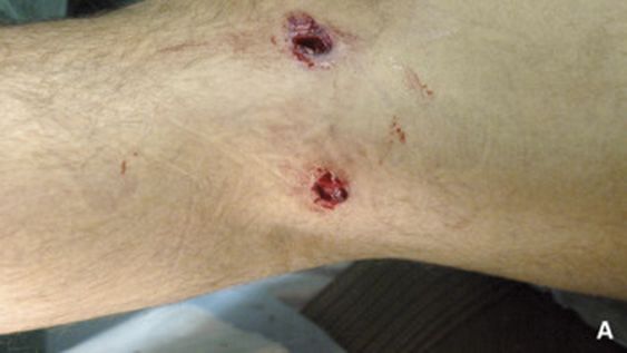 Lo emboscaron, le balearon una pierna y en la Policía creen que fue un ajuste de cuentas