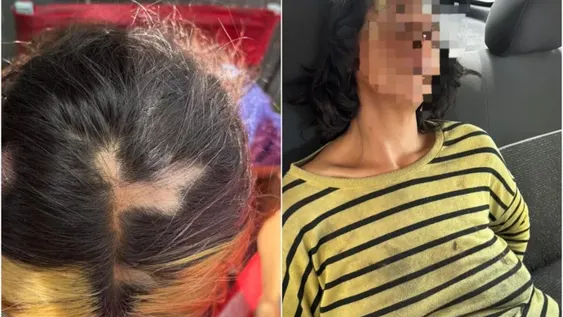 Una mujer le arrancó varios mechones de cabello a otra durante una pelea callejera