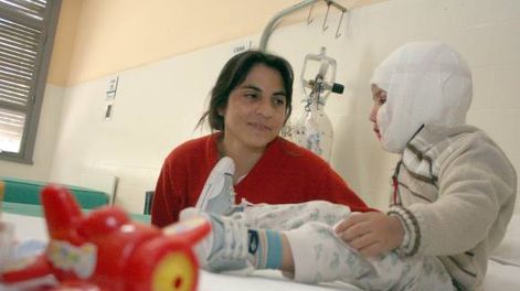 Quemados  internados: el  65% son niños