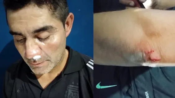 Suspensión y caos en Villa Krause