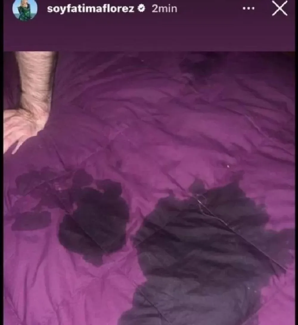 Fátima habló de su foto viral: con quién estaba en la cama y qué fue lo que manchó su acolchado