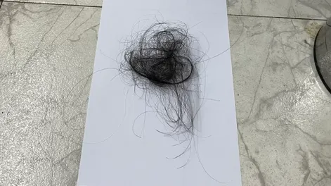 La terrible agresión a una docente: la alumna le arrancó mechones de pelo y la madre le pegó una trompada