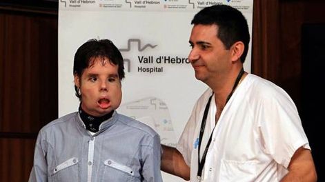 La nueva cara del primer trasplantado