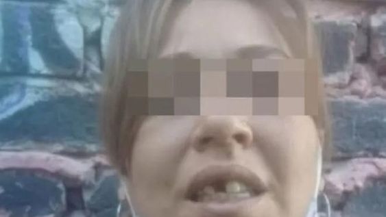 Tres años de cárcel para el sujeto que golpeó a su pareja y le quemó la mano con una estufa