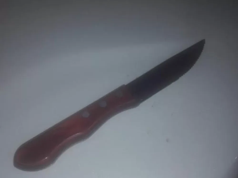 Le perforaron un ojo con un cuchillo en medio de una pelea