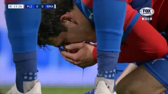 El video del codazo de Ramos que hizo sangrar a Milan Havel