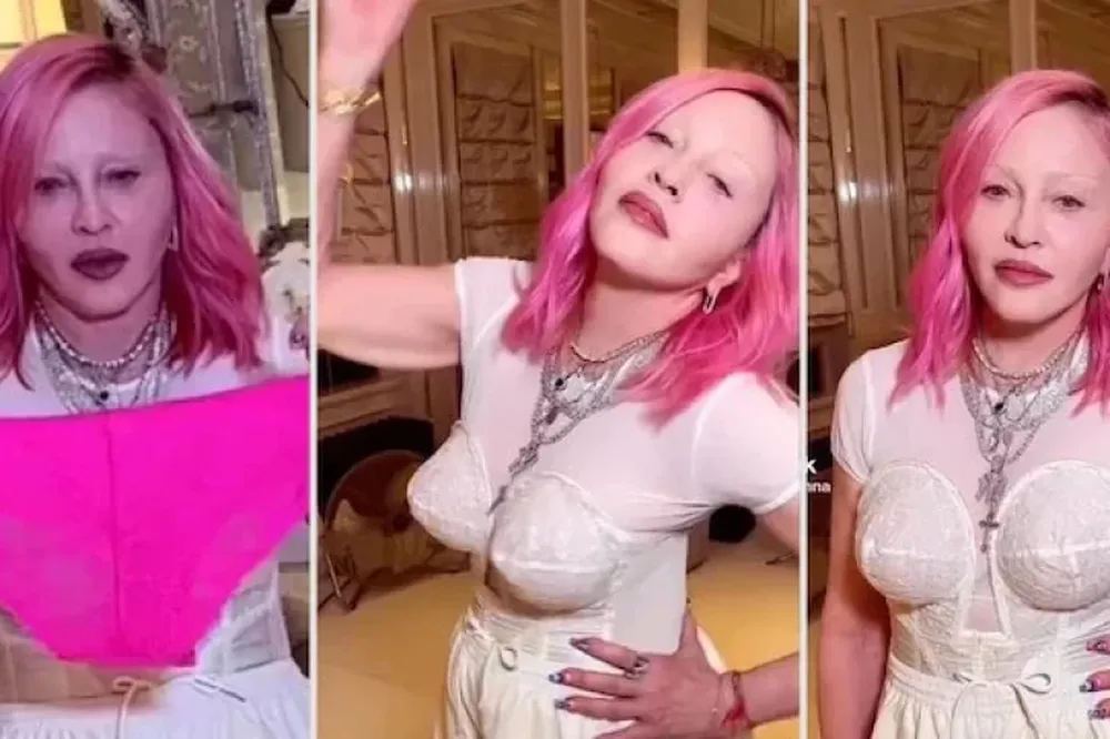 El impactante nuevo rostro de Madonna: “Parece una…”