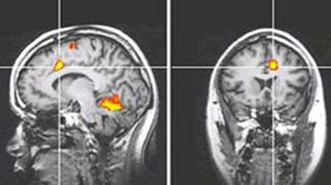 Crean detector del dolor